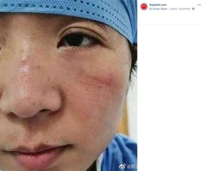 Wuhan'da çalışan sağlık personelinin ürküten görüntüleri