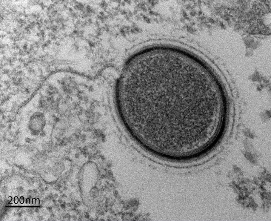 Ünlü gazetecinin sözleri gündem oldu: Frankenvirus uyarısı!