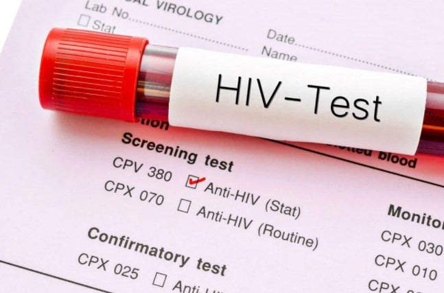 Kovid-19 ile enfekte olan HIV/AIDS hastası vücudunda 21 mutasyon geliştirdi