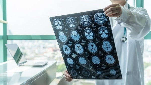 30'lu yaşlara dikkat: Alzheimer'ın en büyük sebebi...