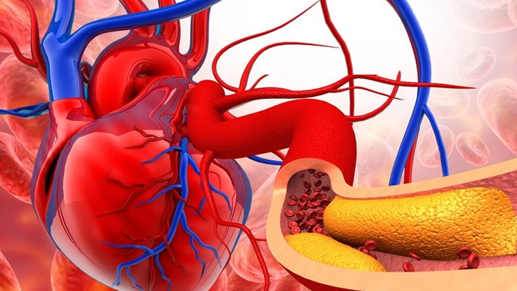 Bu hisse dikkat edin: Kolesterolün işareti olabilir!