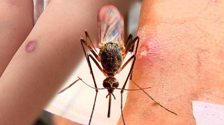 İstanbul'da yeni tehlike: AEDES