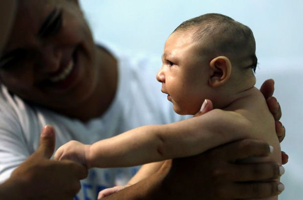 Zika virüsü nedir ve nasıl bulaşır?