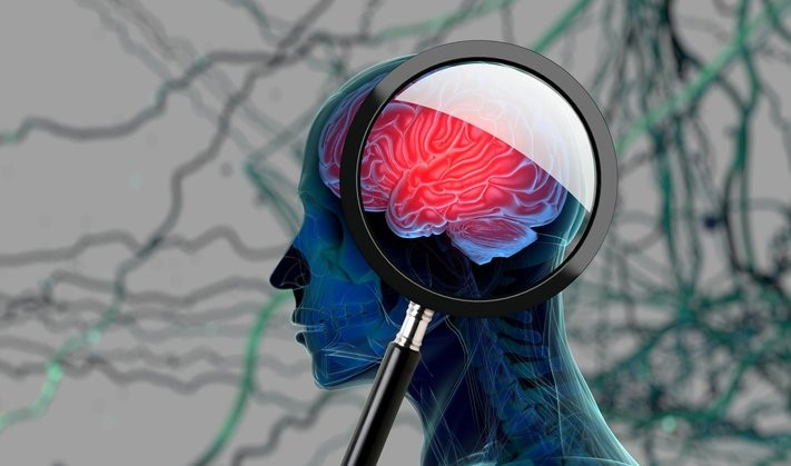 Alzheimer 20 yıl önce bu belirtiyle sinyal veriyor: Bu besin riski sıfırlıyor!