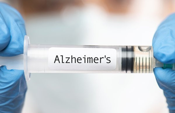 Erken dönem Alzheimer belirtileri: Beynin sessiz çığlığı!