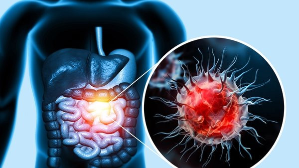 Kanserin ana sebebiymiş: Doktorların önemle vurguladığı 5 madde!