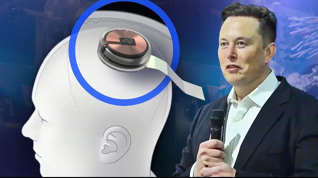 Musk onay aldı: İnsanlar üzerinde beyin çipi deneyleri başlıyor!