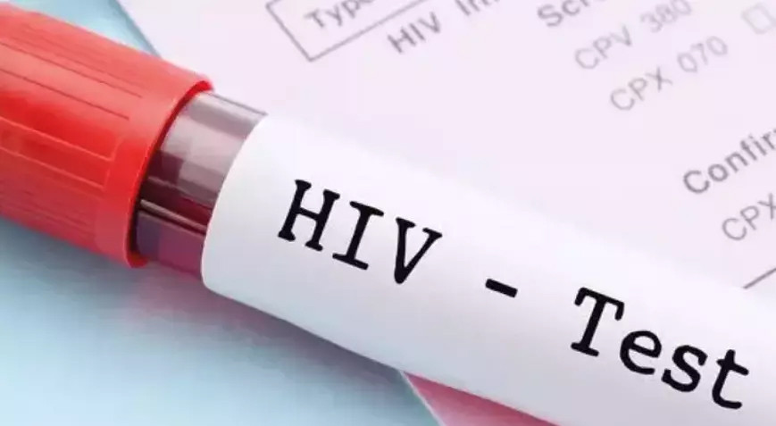 Türkiye'de HIV artış eğiliminde: Gizli pandemi gibi!